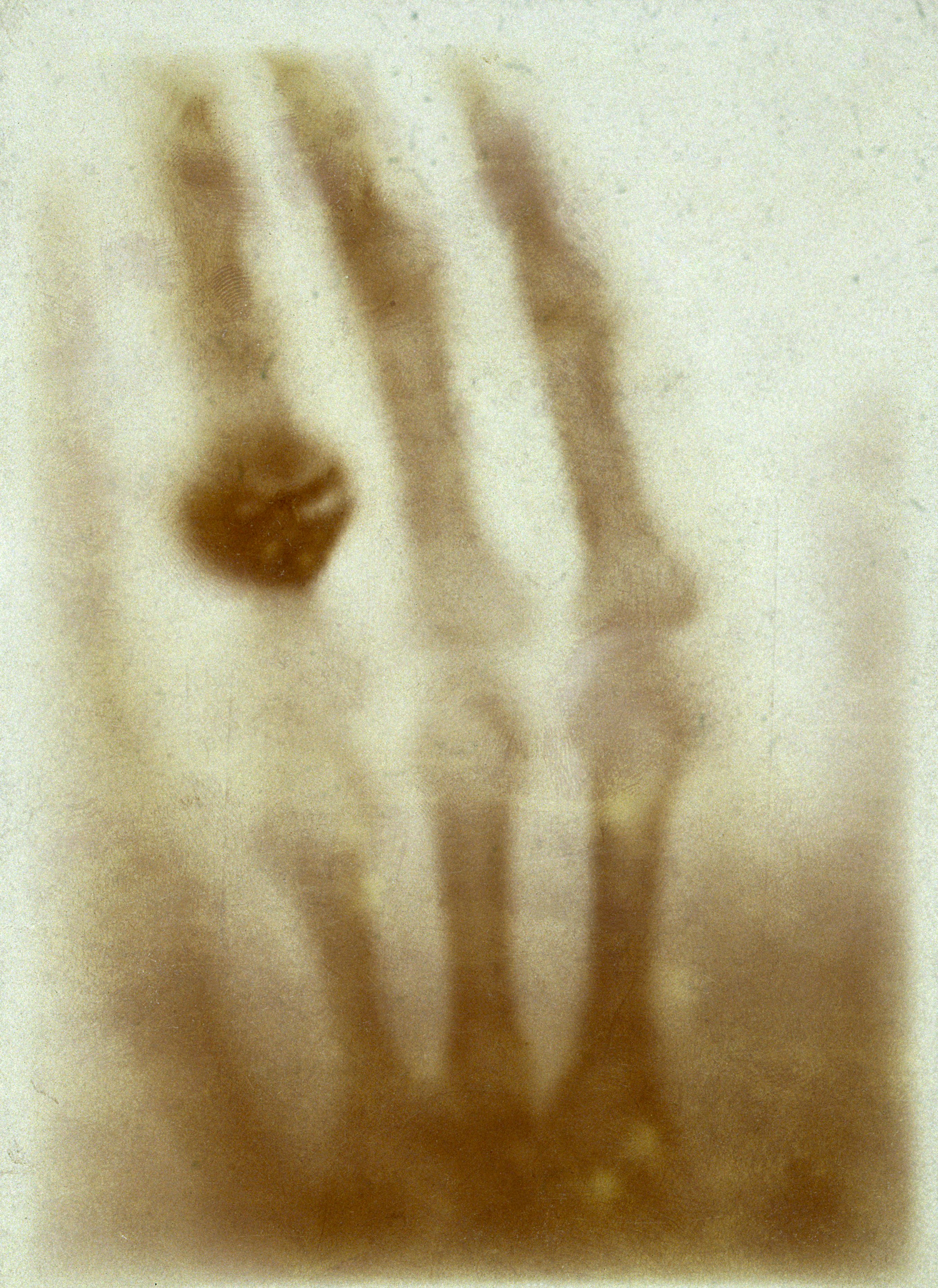De eerste röntgenfoto ooit (img-small)